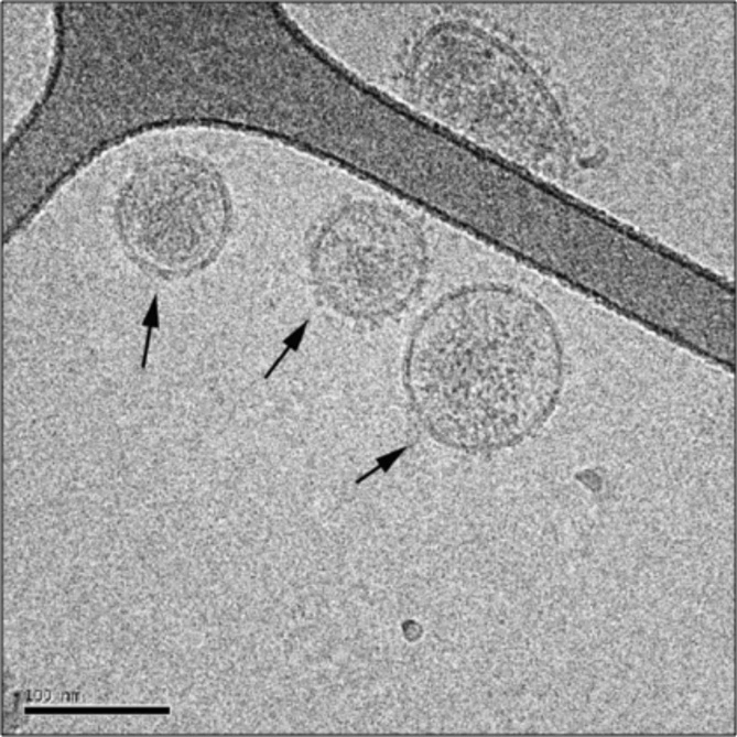 Cryo-electron micrograph of exosomes from prostate epithelial cells (prostasomes) (Raposo, G. and Stoorvogel, W. 2013).